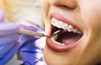 What Does an Orthodontist Do? A Complete Guide