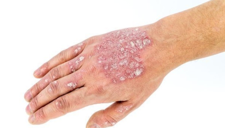 Best Botox and Dermatology Services in Irvine, CA: A Complete Review