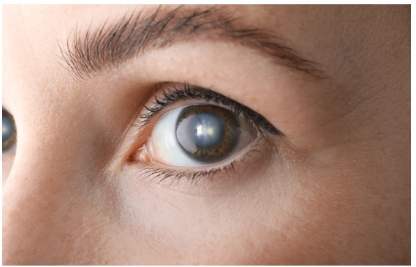 What is the Best Eye Clinic in Mira Road? A Complete Guide to Quality Vision Care What is the Best Eye Clinic in Mira Road? A Complete Guide to Quality Vision Care