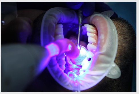 Finding the Best Dentist in Mulund: Your Complete Guide to Quality Oral Care Finding the Best Dentist in Mulund: Your Complete Guide to Quality Oral Care